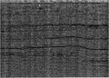 Figure 1.5-51  CMP stack as in Figure 1.5-50 with the additional step in the processing sequence for AGC scaling of the poststack data.
