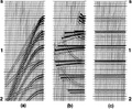Figure 6.1-21  (a) The modeled CMP gather in Figure 6.1-9c, (b) after NMO correction using the multiple velocity function (V M in Figure 6.1-9d). (c) The stack trace is repeated to emphasize the strong events.]]