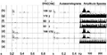 Figure 2.4-35  Predictive deconvolution for multiple attenuation. (a) Reflectivity, (b) impulse response, (c) seismogram. Two-step deconvolution: Predictive deconvolution (d) followed by spiking deconvolution (e). Traces (f), (g), and (h) result when single-step deconvolution is applied to the input trace (c), using the operator lengths n and prediction lags α, as indicated.