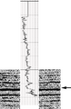 Figure 11.3-26  A portion of Inline 76 from the image volume derived from 3-D poststack time migration with the sonic log as in Figure 11.3-25a inserted at well location, Crossline 79.