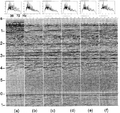 Figure 11.3-3  A portion of a CMP stack for a test for optimum stacking fold using different cable lengths: (a) using an optimum mute pattern that minimizes angle dependency of seismic amplitudes, (b) using a mute pattern that provides a full-offset stack, (c) 75 percent near-offset stack, (d) 50 percent near-offset stack, (e) 25 percent near-offset stack, and (f) 17 percent near-offset stack. On top of each panel is the amplitude spectrum averaged over the shot record, and at the bottom is the autocorrelogram.
