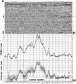 Figure 3.4-36  (a) A CMP stack with refraction statics applied using the generalized reciprocal method (compare with Figures 3.4-34a and Figure 3.4-37a), (b) estimated multiple intercept times at each shot-receiver station and the computed shot (open squares) and receiver (solid dots) statics.