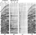 Figure 6.4-16  (a) A deep-water CMP gather with strong multiples; (b) the conventional velocity-stack gather; (c) the proper velocity-stack gather; (d) the CMP gather reconstructed from (c). Compare with (a) and note the preservation of amplitudes along hyperbolic events. (Data courtesy Norwegian Petroleum Directorate.)