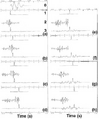 Figure 2.3-6  Shaping filtering. (0) Input wavelet, (1) desired output, (2) shaping filter operator, (3) actual output. Here, the purpose is to convert the mixed-phase wavelet (0) to a series of delayed spikes as shown in (a) through (h) using a two-sided operator (with memory and anticipation components). The best result is obtained with a zero-delay spike using a two-sided filter (a).
