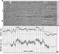 Figure 3.4-41  (a) A CMP stack with refraction statics applied using the generalized reciprocal method (compare with Figures 3.4-39a and Figure 3.4-42a), (b) estimated intercept times and the computed shot (open squares) and receiver (solid dots) statics.