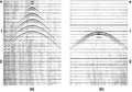 Figure 4.1-18  (a) Superposition of the time sections in Figure 4.1-17; (b) removing the translational effect by retardation to place the energy at the apex of the hyperbola obtained initially along the beach line.]]