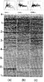 Figure 11.3-4  A portion of the CMP stack as in Figure 11.3-3a after: (a) poststack f − x deconvolution to attenuate random noise, (b) spiking deconvolution, and (c) time-variant spectral whitening. On top of each panel is the amplitude spectrum averaged over the shot record, and at the bottom is the autocorrelogram.