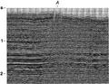 Figure 3.4-44  A CMP stack with field statics applied. Note the unresolved long-wavelength statics manifested by the spurios structural high below midpoint A.