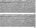 Figure C-10  The CMP stacked section of the data in Figure 3.4-29 (a) after refraction statics using an L1-norm scheme for refraction statics, and (b) followed by residual statics corrections. Compare with Figure 3.4-29 and note the significant improvement of CMP stacking as a result of resolving both long- and short-wavelength statics anomalies by refraction and residual statics corrections, respectively. Also, compare with Figure 3.4-32 and note that the results of L1- and L2-norm statics solutions, in this case, yield very similar results.