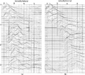 Figure 6.4-26  Velocity spectra associated with (a) the CMP gather in Figure 6.4-25a; (b) the CMP gather in Figure 6.4-25d.