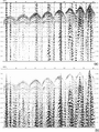 Figure 11.3-20  (a) A raw shot record from the 3-D seismic data associated with the case study presented in acoustic impedance estimation, (b) after geometric spreading correction. (Data courtesy Talisman Energy.)