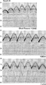 Figure 7.2-2  Part 6: Selected shot records from the 3-D survey of Figure 7.2-1. Note that each shot record comprises subrecords associated with each of the six receivers lines in the swath as sketched in Figure 7.2-1.