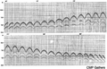 Figure 8.2-3  A selection of CMP gathers derived from sorting of the modeled common-shot gathers as in Figure 8.2-2. Numbers on top represent the CMP location. No amplitude scaling has been applied to the data.
