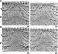 Figure 7.0-11  (a) A cross-section from a 3-D volume of CMP-stacked data associated with a land 3-D survey without 3-D DMO correction; (b) with 3-D DMO correction; (c) same cross-section as in (a) after 3-D poststack time migration; (d) same cross-section as in (b) after 3-D poststack time migration.