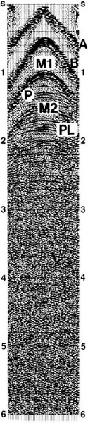 File:Ch01 fig3-24.png