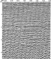 Figure 10.5-7  The Gulf of Thailand line: depth image from poststack depth migration using the velocity-depth model shown in Figure 10.5-4. Depth image from prestack depth migration is shown in Figure 10.5-5.