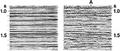 Figure 6.4-27  (a) A portion of the CMP stacked section associated with the CMP gather in Figure 6.4-25a with short-period multiples; (b) same portion of the CMP stacked section associated with the CMP gather in Figure 6.4-25d with velocity-stack processing for multiple suppression. Note the apparent lateral continuity caused by the short-period multiples in (a); this false continuity is removed in (b), thereby uncovering a probable subtle structural feature at 1.5 s below midpoint A. (Data courtesy Abu Dhabi National Oil Company.)